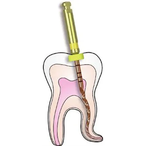 DIADENT DIA-X FEILE D3 FINISHING FEILE 21mm GELB F1 (4 Stück)
